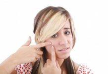 Acne —facts more than skin deep myths-about-acne