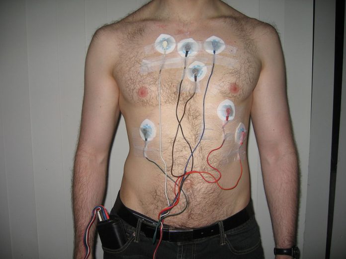 Holter Monitoring Device
