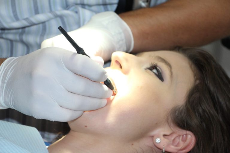 Dentist working on teeth