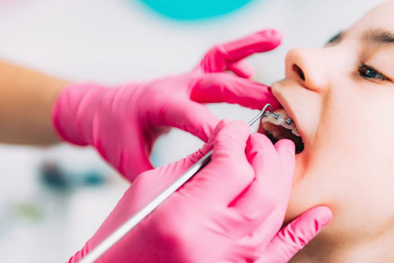 orthodontist checking girls dental braces