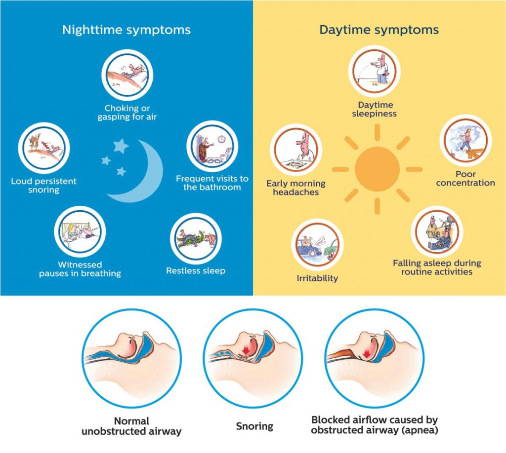 What is the impact of stress on sleep during Coronavirus lockdown? 1